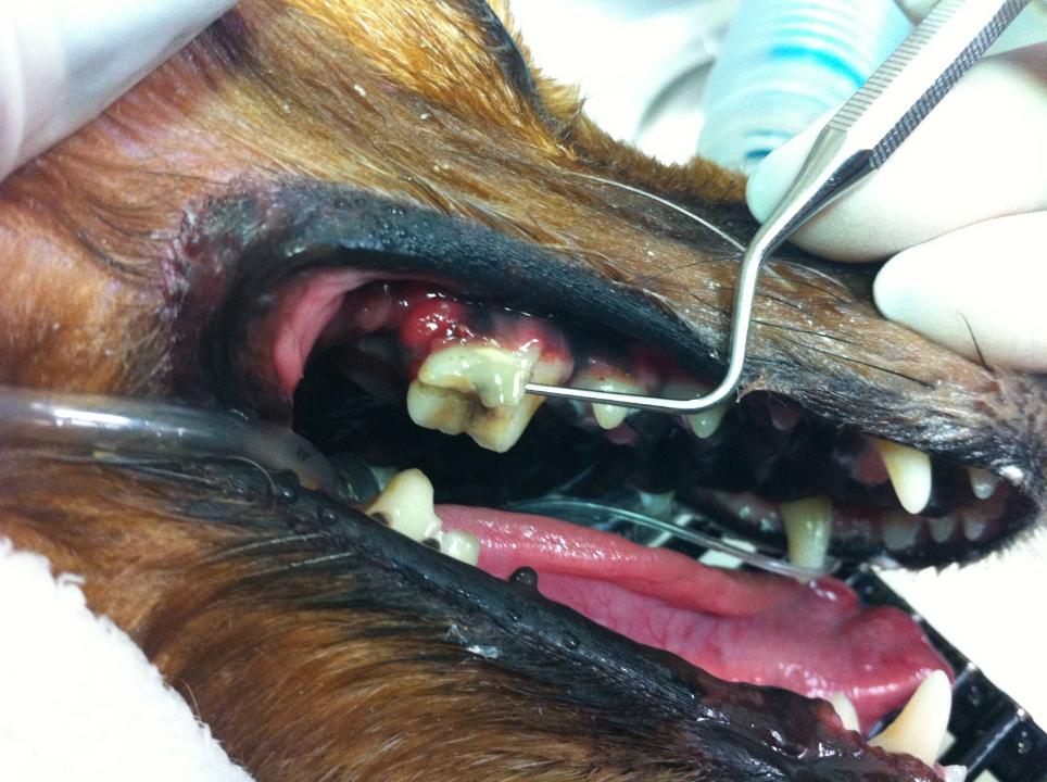 broken-tooth