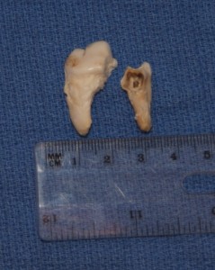extracted dog teeth